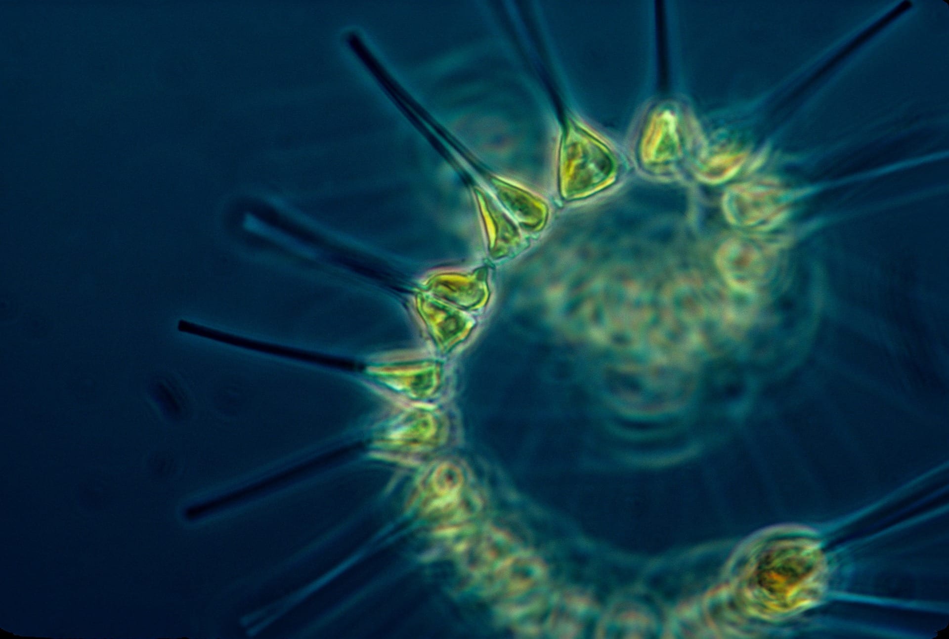 https://pixabay.com/en/phytoplankton-plankton-1348508/