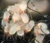 House Dust Mites Photo By: Gilles San Martin Https://Creativecommons.org/Licenses/By-Sa/2.0/ 